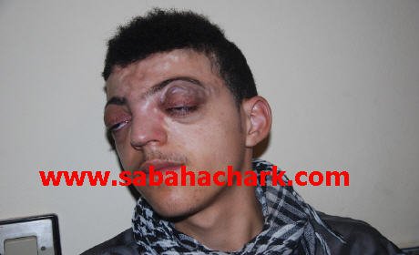 عامل إقليم بركان وجمعية المواساة يخلفان وعدهما مع الطفل أسامة