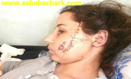 مجهولون يعتدون على مهندسة ببلدية الرباط