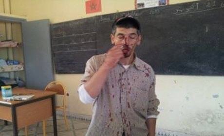 تلميذ بثانوية “عبد الرحمان بن عوف” بوجدة يهاجم أستاذا بواسطة سيف داخل فصل دراسي