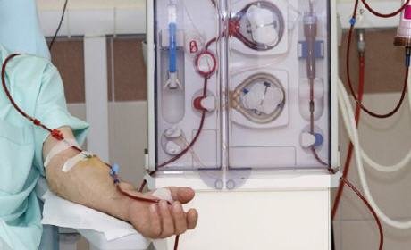 أرقام صادمة حول القصور الكلوي في المغرب