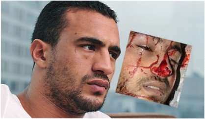 سنتان سجنا للبطل العالمي بدر هاري لاعتدائه على رجل أعمال هولندي