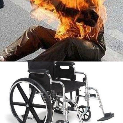  وفاة ‘مُعاق’ أحرق جسده بالبنزين بزايو وسط تضارب للأنباء حول السبب