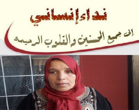 نداء إنساني من أجل مساعدة سيدة لإجراء عملية جراحية على مستوى العين