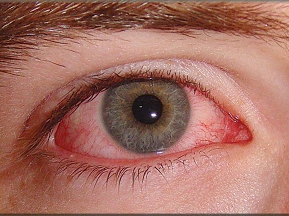  العيون - www.sabahachark.com