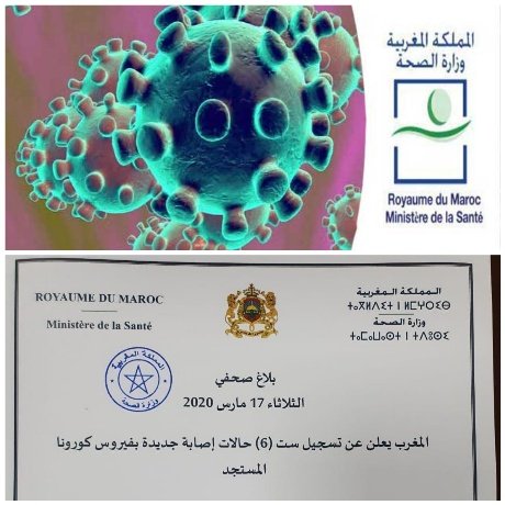 عاجل..وزارة الصحة تعلن عن تسجيل 6 حالات إصابة جديدة بفيروس كورونا