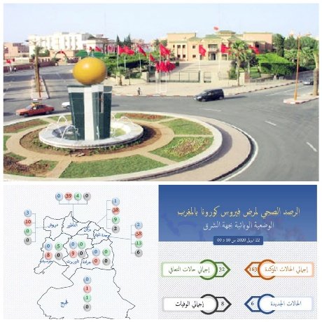 عاجل…تسجيل حالة جديدة بفيروس كورونا ببركان ليرتفع العدد بإقليم بركان إلى 38 حالة