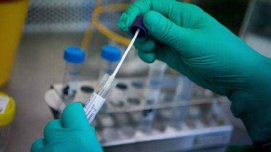 وزارة الصحة تنفي اقتناء اختبارات الكشف عن “كوفيد-19” منتهية الصلاحية