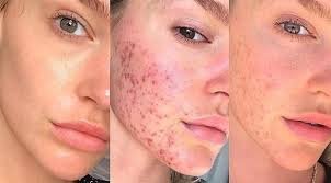  الشباب - www.sabahachark.com