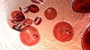 الملاريا تنتشر بالجزائر وتسجل 1110 إصابات