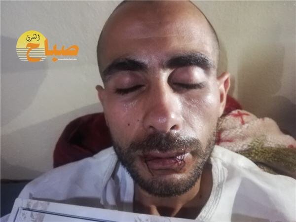 fam idrab el aioun 1 - www.sabahachark.com